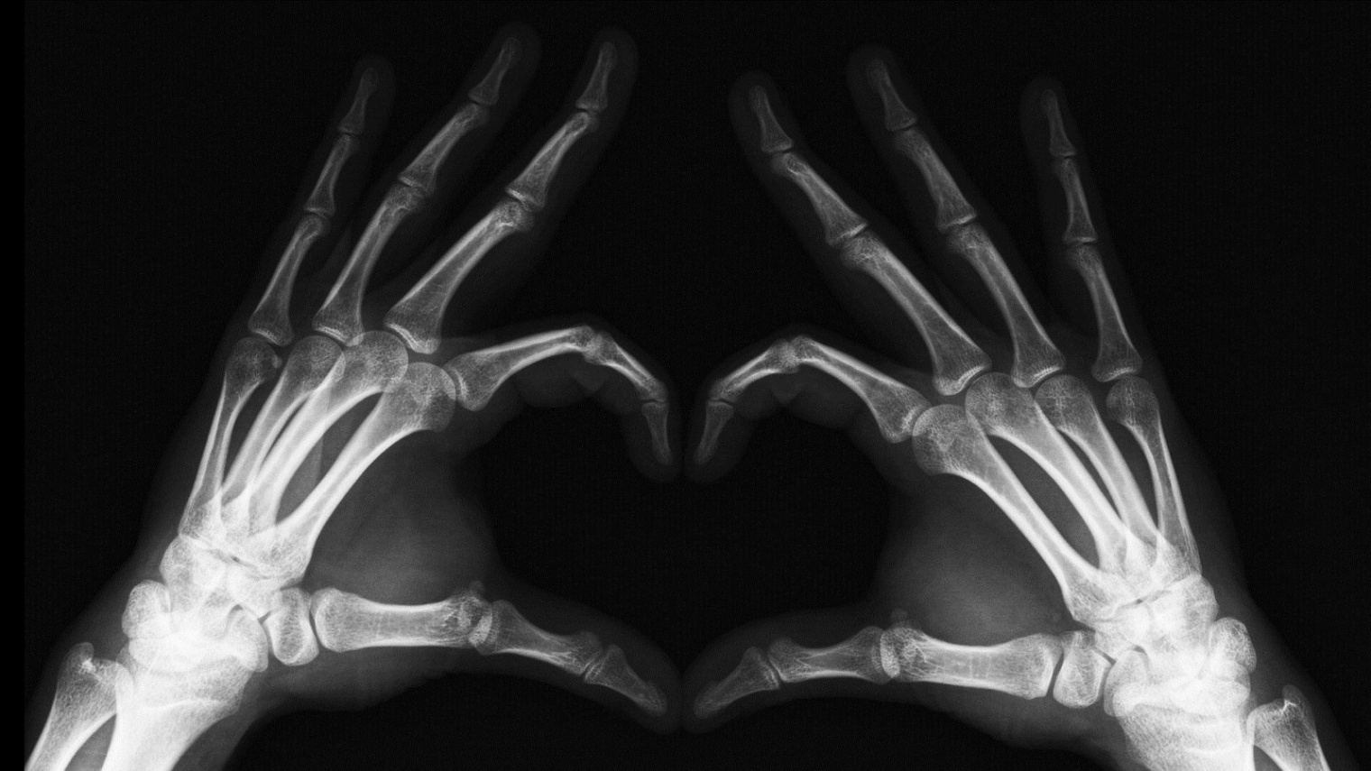 finger-heart-xray-x  Golan Levin  Flickr