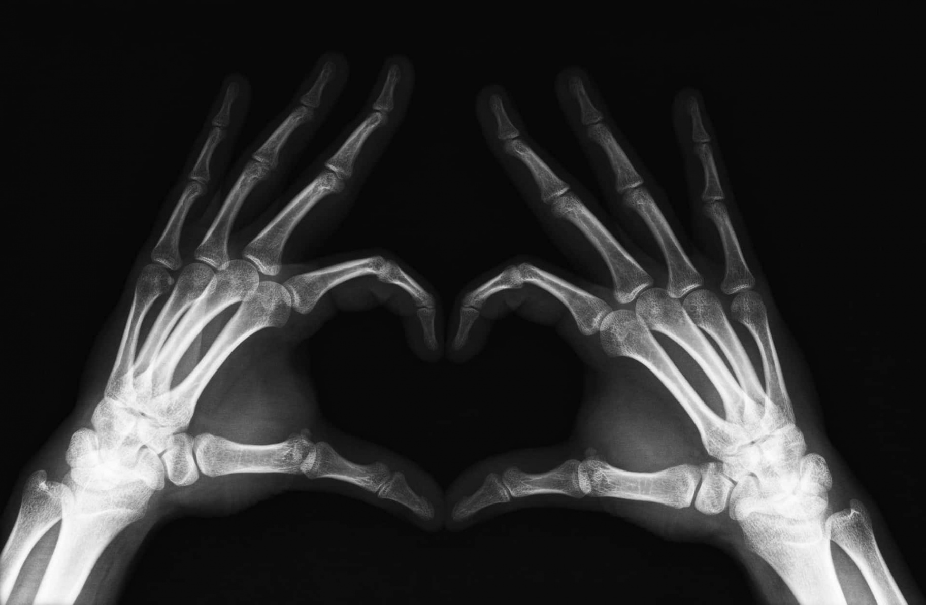 +] X Ray Pictures  Wallpapers